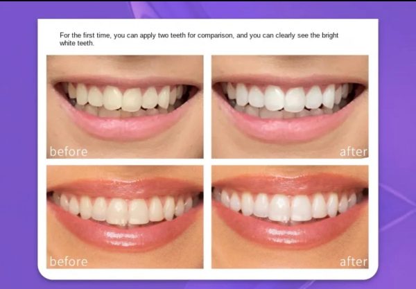 Teeth Brightening Hismiles V34 Colour Corrector Serum 30ml.